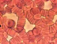 swine vaccines blood flu protection blood